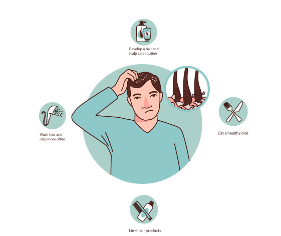 DANDRUFF Treatment CLINIC IN CHENNAI