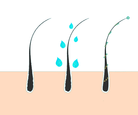 GFC HAIR Treatment CLINIC IN CHENNAI