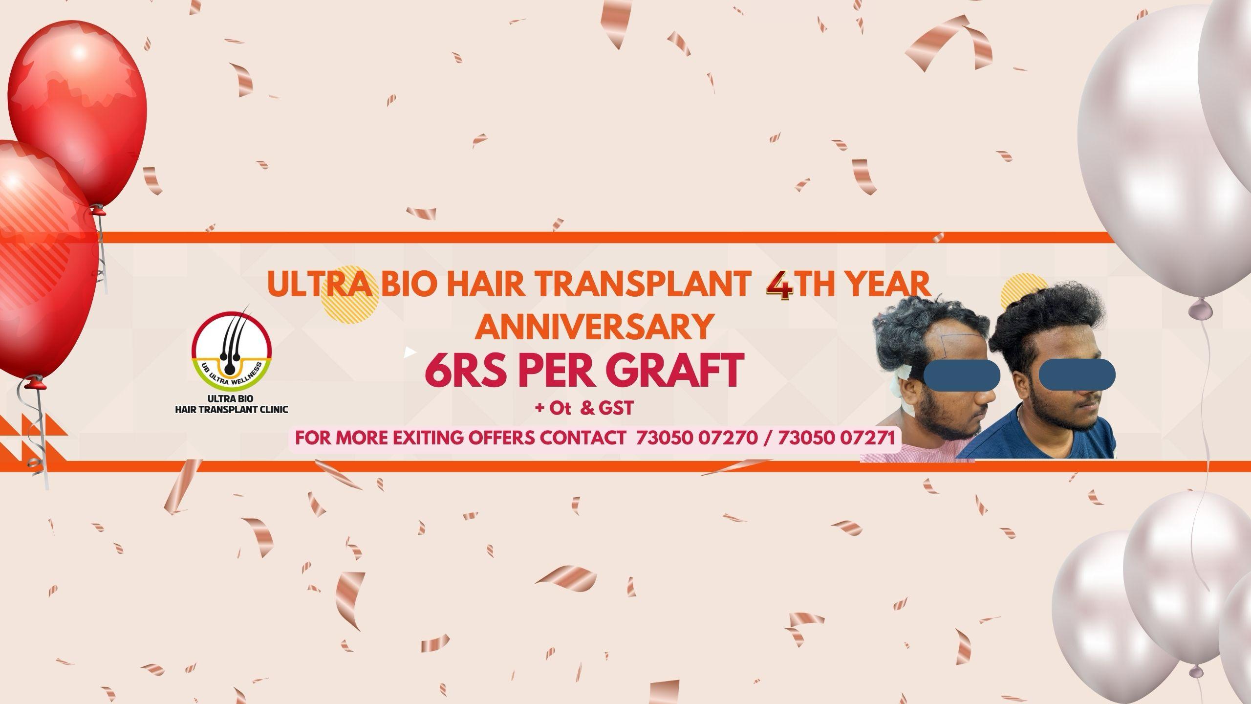 Check with client. Still we need this?
Diwali special offer hair transplant treatment
